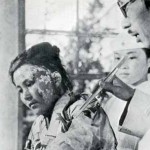 Queimadura radioativa "leve" - apesar da intensidade e da área afetada, os médicos pouco puderam fazer por esta paciente. Faltava até gaze para curativos. Foto: Hiroshima Peace Memorial Museum
